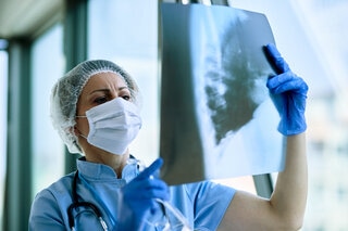 Doctor examining X-ray film of patient as a part of heart check-up.