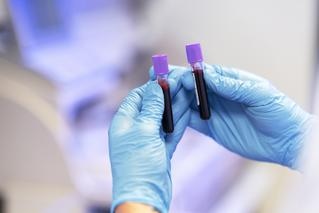Blood samples taken in test tube for blood test related to heart check-up.