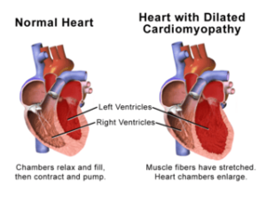 Cardiomyopathy is  most common cardiac disease during pregnancy