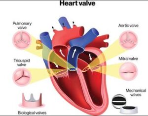 Heart valve diseases is  most common cardiac disease during pregnancy